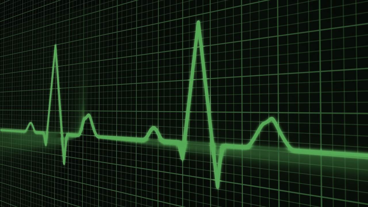 Heart rate monitor
