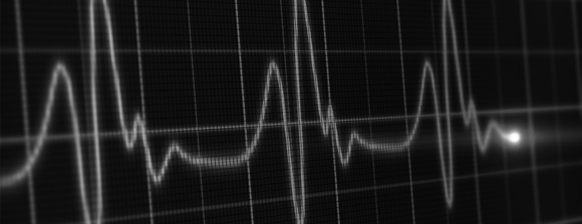 Heart rate monitor