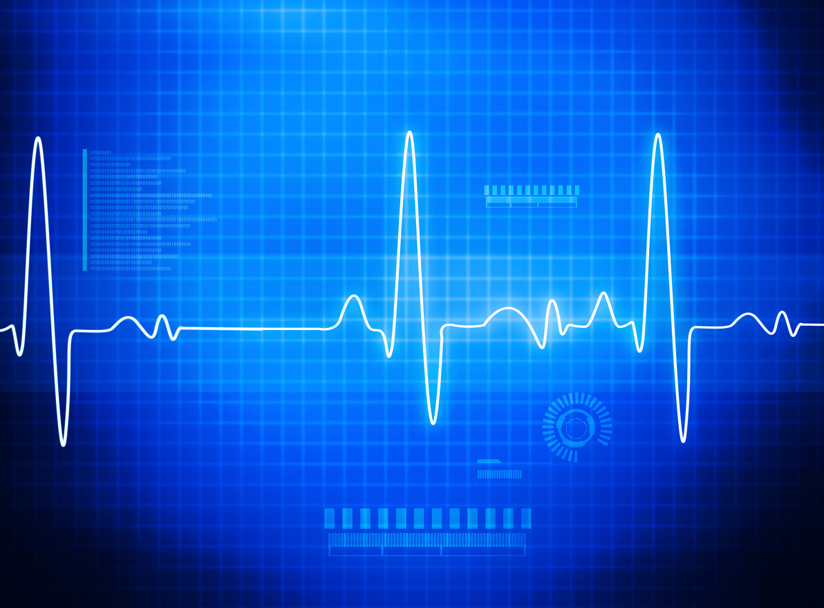 ECG electrocardiography image