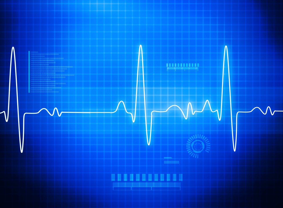 ECG electrocardiography image